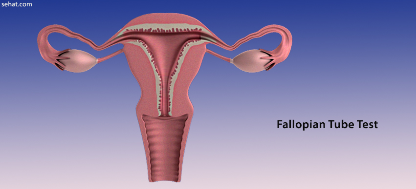 Fallopian Tube Test - Preparation, Procedure, Results, Side Effects