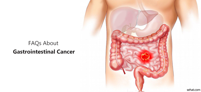 9 FAQs About Gastrointestinal Cancer