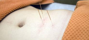 Is Acupuncture Effective for Getting Pregnant?
