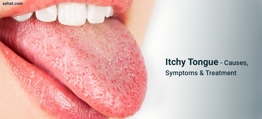 Itchy Tongue: Reasons And Treatment
