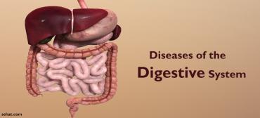 What are some common digestive diseases?