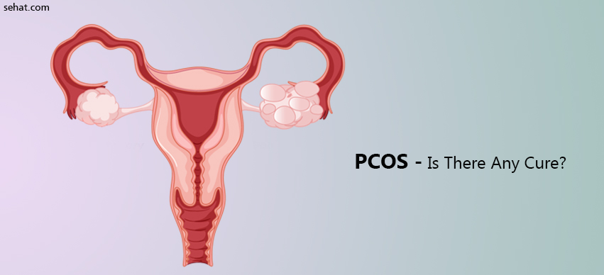 PCOS (Polycystic Ovarian Syndrome) - Is There Any Cure?