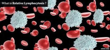 Relative Lymphocytosis - Causes, Symptoms, Treatment