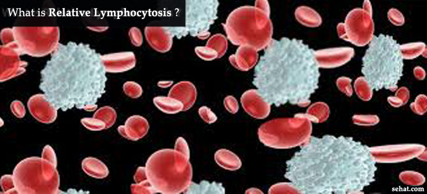 Relative Lymphocytosis - Causes, Symptoms, Treatment