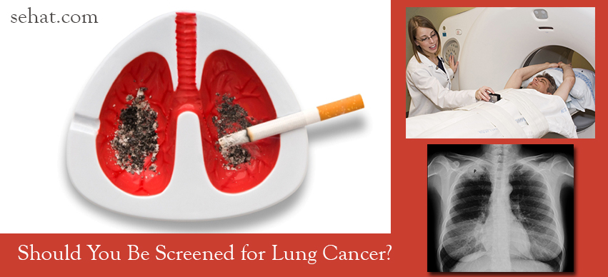 Should You Be Screened for Lung Cancer?