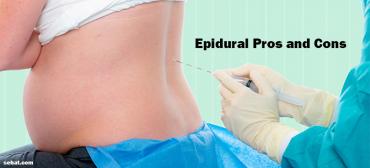 The Pros and Cons of Epidural