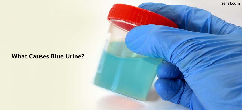 What Causes Blue Urine?