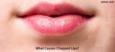 What Causes Chapped Lips And How to Cure Them?