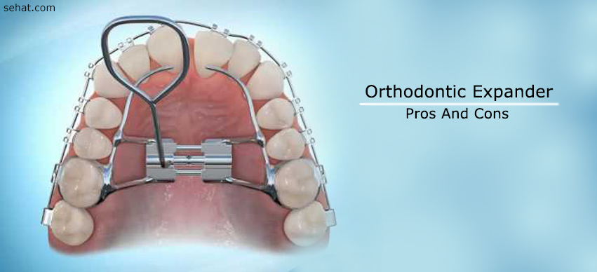 What Are The Orthodontic Expander Pros And Cons? And Why Should You Care?