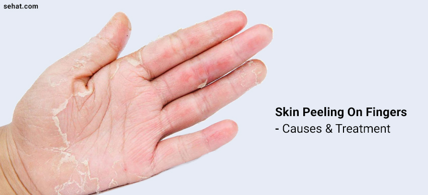 Finger Skin Peeling