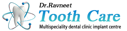 Dr. Ravneet Tooth Care Multispeciality Dental Clinic Implant Centre