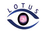 Lotus Eye Care Hospital Ernakulam, 