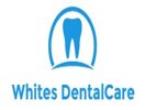 Whites Dental Care Hyderabad