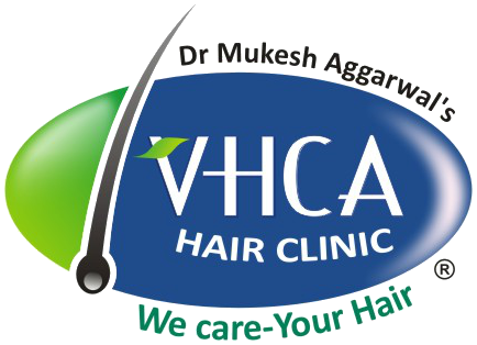 VHCA Hair Clinic Gurgaon