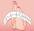 Complete HEART Rhythm Solutions - CHRS