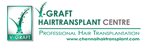 V Graft Hairtransplant