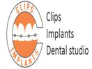 Clips & Implants Dental Studio Hyderabad
