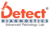 Detect Diagnostics