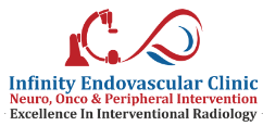 Infinity Endovascular Clinic Jaipur