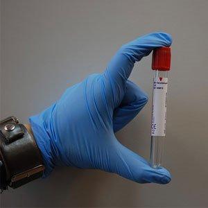 UK scientists come up with blood test that may make detecting all cancers possible